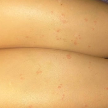 Necmi Kadıoğlu Devlet Hastanesi Kızılay Ek Bina Doktordan Şikayetçiyim!