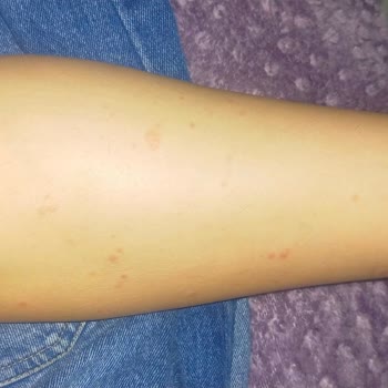 Necmi Kadıoğlu Devlet Hastanesi Kızılay Ek Bina Doktordan Şikayetçiyim!