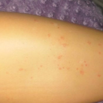 Necmi Kadıoğlu Devlet Hastanesi Kızılay Ek Bina Doktordan Şikayetçiyim!