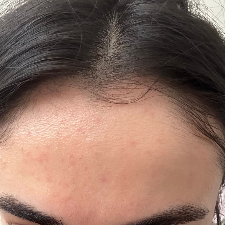 Cilt Bakım Ürünleri Kızarıklık Sorunu