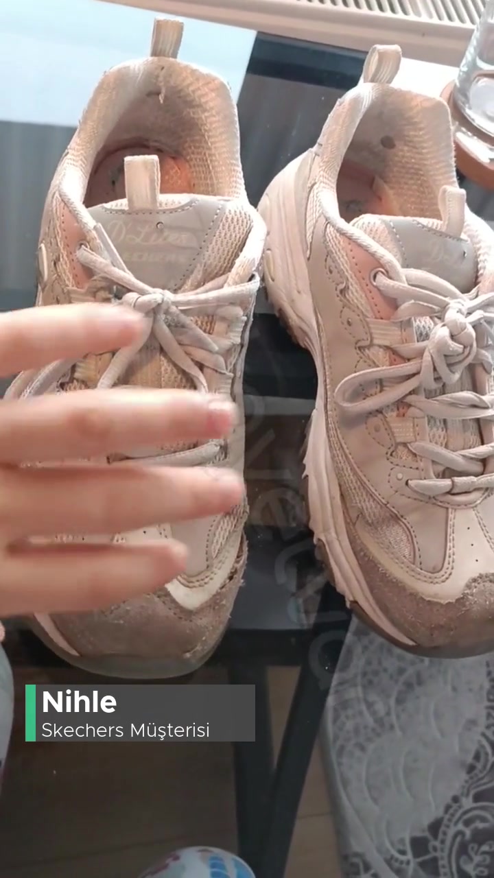 Skechers Ayakkabısının Dikiş Söküğü/ Kalite Düşüşü! videonun kapak resmi