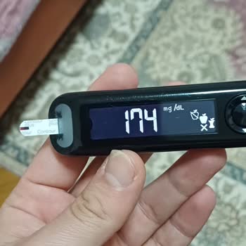 Sensör Ölçümünde Güven Sorunu Ve Müşteri Hizmetlerine Erişememe