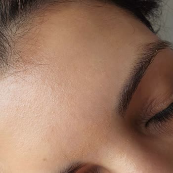 Bioderma Ürünü Yüzde Pütürlenme Sorunu