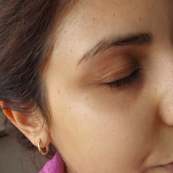 Bioderma Ürünü Yüzde Pütürlenme Sorunu