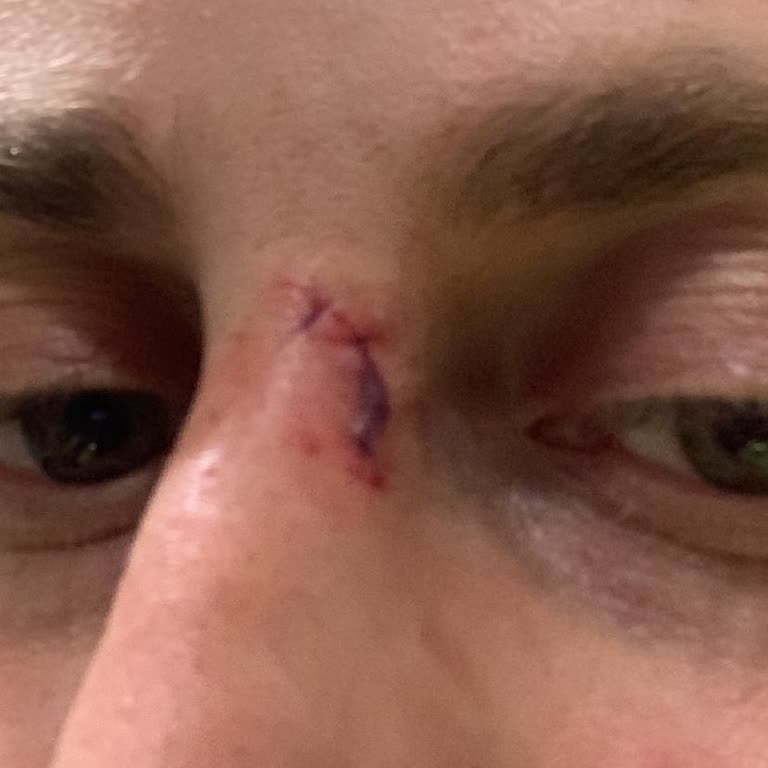 Spor Salonunda Güvenlik İhmali: Yaralanma Ve İlgisizlik