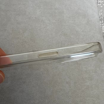 Vatan Bilgisayar'dan Aldığım Kılıf Sarardı