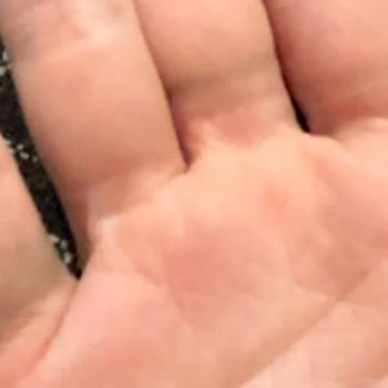 Kalitesiz Materyal: Yüzükler Gri İz Bırakıyor