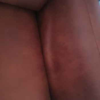 Yanlış Kurulum Ve Kalitesiz Malzeme Sorunu