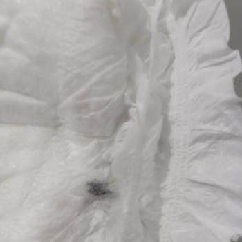 Bebek Bezi İçinde Tehlikeli Cisim