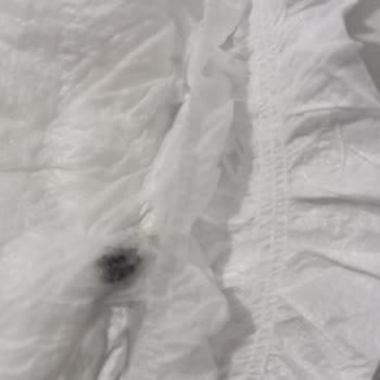 Bebek Bezi İçinde Tehlikeli Cisim