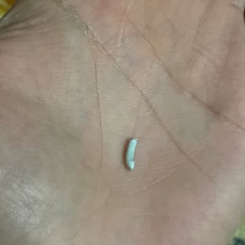 Tost Malzemesinden Çıkan Yabancı Cisim Sorunu