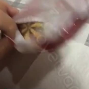 Eti Tutku İçinden Taş Çıktı!