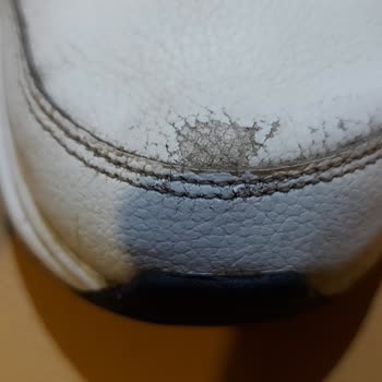 Aldığım Adidas Ayakkabının Kalitesizliği Ve İnceleme Sürecinin Yetersizliği