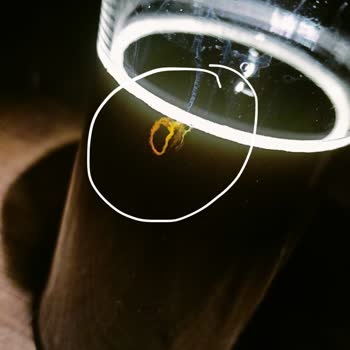 E-Bebek Mavi Promalt İçinde Yabancı Madde Şoku