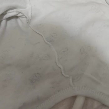 Molfix Bebek Bezinde Sızdırma Sorunu