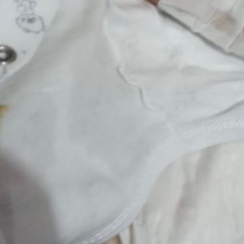 Molfix Bebek Bezinde Sızdırma Sorunu