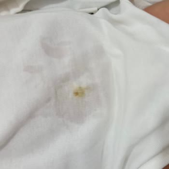 Molfix Bebek Bezinde Sızdırma Sorunu