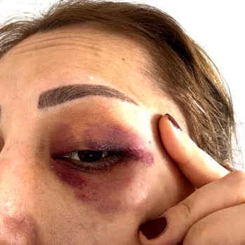 Güvenlik İhmali Yüzünden Sağlık Ve İş Hayatı Tehlikede