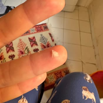 Kahvaltıda Taze Kaşardan Çıkan Cam Parçası Şoku