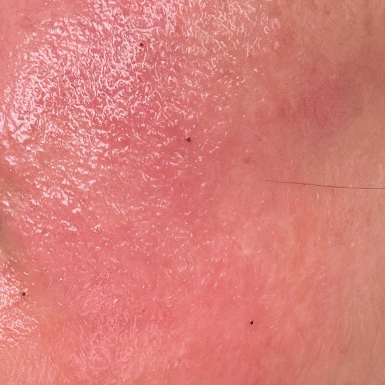 Bee Beauty Maske Yüzümde Kızarıklık Ve Yanma Yaptı