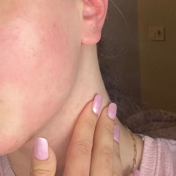 Doktor Tavsiyesiyle Alınan Takviyeler Sağlık Sorunlarına Yol Açtı