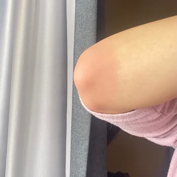 Doktor Tavsiyesiyle Alınan Takviyeler Sağlık Sorunlarına Yol Açtı