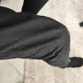 Toz Toplayan Pantolon Sorunu