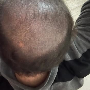 Hayal Kırıklığı Yaratan Saç Simülasyonu Deneyimi: İlgisiz Hizmet Ve İade Sorunları