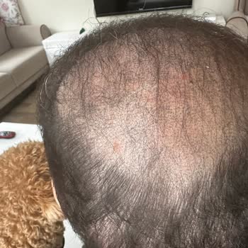 Hayal Kırıklığı Yaratan Saç Simülasyonu Deneyimi: İlgisiz Hizmet Ve İade Sorunları