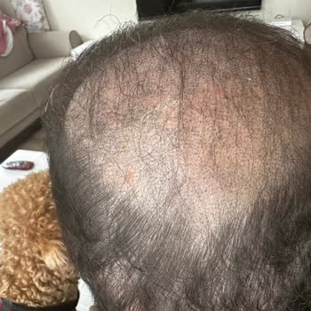 Hayal Kırıklığı Yaratan Saç Simülasyonu Deneyimi: İlgisiz Hizmet Ve İade Sorunları