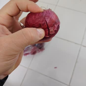 Migros'tan Gelen Bozuk Ürünler Ve Yanıltıcı İade Süreci