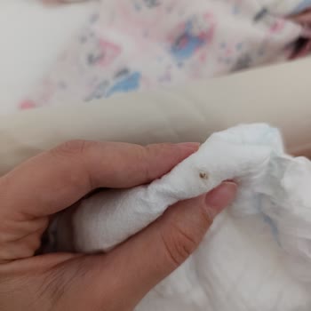 Molfix Bezinde Beklenmedik Yabancı Madde Şoku