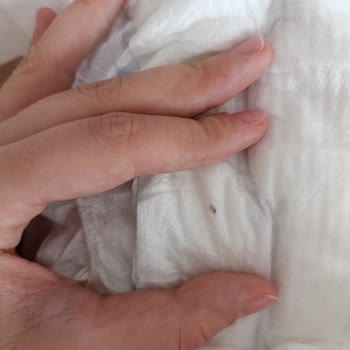 Molfix Bezinde Beklenmedik Yabancı Madde Şoku
