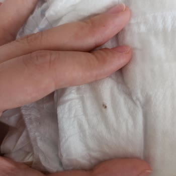 Molfix Bezinde Beklenmedik Yabancı Madde Şoku