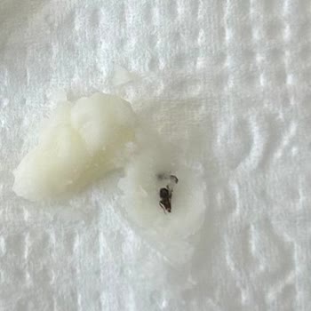 Böcekli Peynir Ve Ulaşılamayan Müşteri Hizmetleri