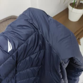 Nautica Mont Tüy Dökme Sorunu Ve Çözüm Eksikliği
