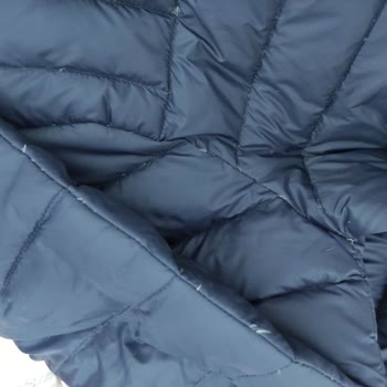 Nautica Mont Tüy Dökme Sorunu Ve Çözüm Eksikliği