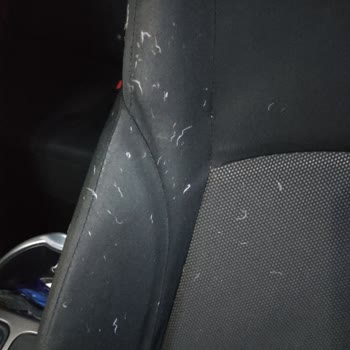 Nautica Mont Tüy Dökme Sorunu Ve Çözüm Eksikliği