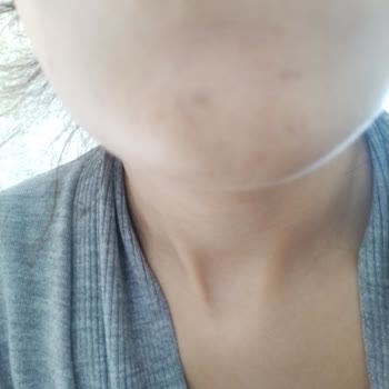 Güzellik Merkezinde Hayal Kırıklığı Ve Maddi Zarar