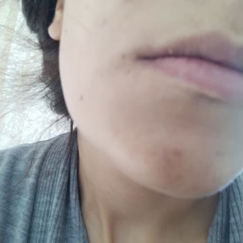 Güzellik Merkezinde Hayal Kırıklığı Ve Maddi Zarar