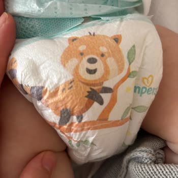 Prima Bebek Bezlerinde Çiş Göstergesi Eksikliği