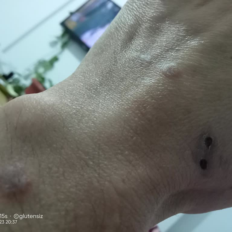 Sağlık Bakanlığı Yetersiz Doktor Sayısı Ve Zorunlu Ankara Yolculuğu