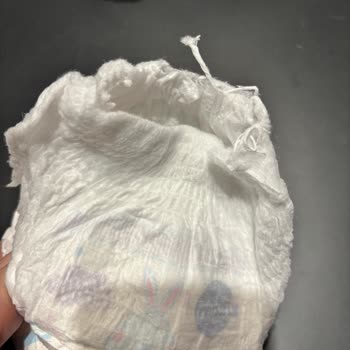 Defolu Molfix Bebek Bezi Sorunu