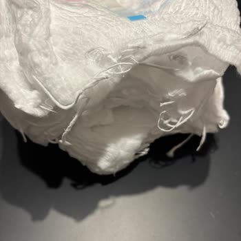 Defolu Molfix Bebek Bezi Sorunu