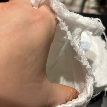 Defolu Molfix Bebek Bezi Sorunu