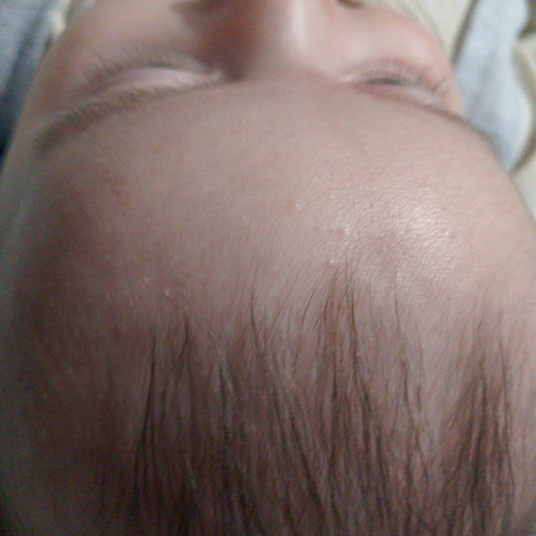 Bebek Şampuanı Cilt Sorunlarına Yol Açtı