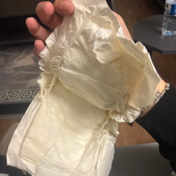 Bebek Bezinde Tebeşir Benzeri Sertlik Şoku