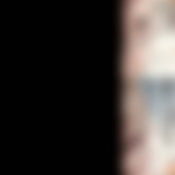 Yeni Alınan Tecno Spark 20 Pro'da WhatsApp Kamera Sorunu