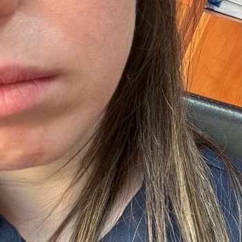 Yüz Yıkama Jelinin Ciltteki Olumsuz Etkisi