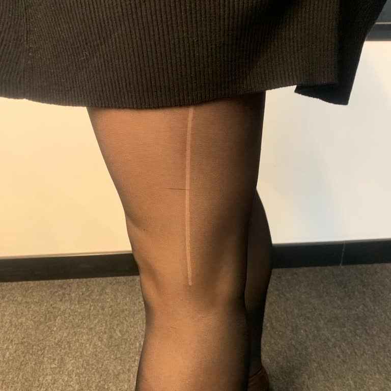 Çorapta Üretim Hatası: Değişim Talebi